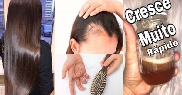 Isso faz crescer cabelo e para de cair! 2 Receitas Poderosas